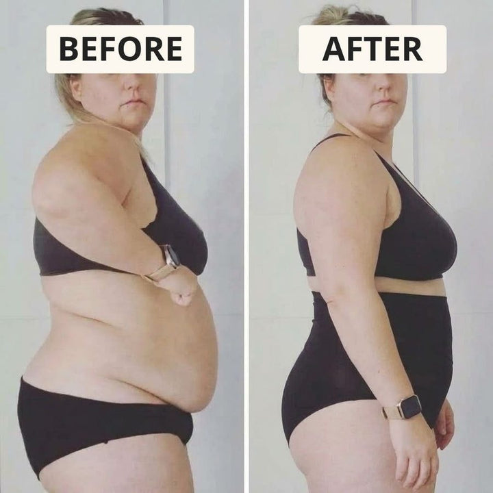 Before and after: side profile, belly flattened